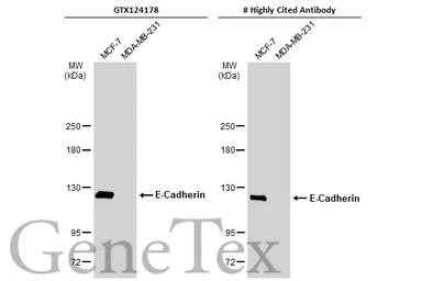 Anti-E-Cadherin antibody [N3C2], Internal used in Western Blot (WB). GTX124178