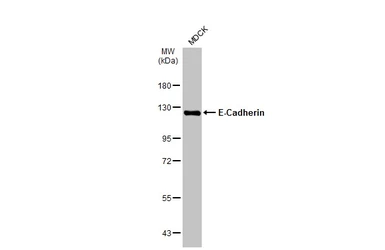 Anti-E-Cadherin antibody [N3C2], Internal used in Western Blot (WB). GTX124178
