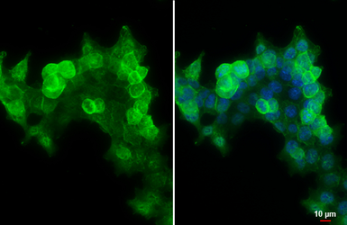 Anti-E-Cadherin antibody [N3C2], Internal used in Immunocytochemistry/ Immunofluorescence (ICC/IF). GTX124178
