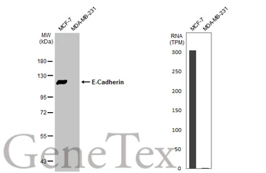 Anti-E-Cadherin antibody [N3C2], Internal used in Western Blot (WB). GTX124178