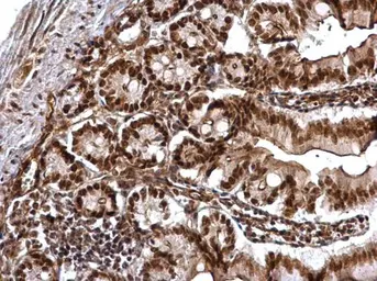 Anti-CHD4 antibody used in IHC (Paraffin sections) (IHC-P). GTX124186