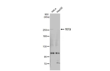 Anti-TET2 antibody [N2-2], N-term used in Western Blot (WB). GTX124205