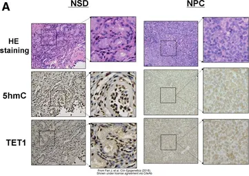 Anti-TET1 antibody [N3C1] used in Immunohistochemistry (IHC). GTX124207