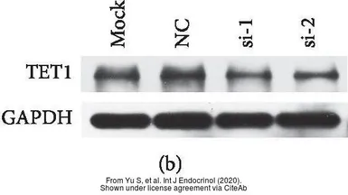 Anti-TET1 antibody [N3C1] used in Western Blot (WB). GTX124207
