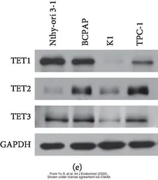 Anti-TET1 antibody [N3C1] used in Western Blot (WB). GTX124207