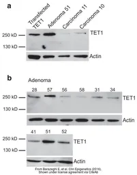 Anti-TET1 antibody [N3C1] used in Western Blot (WB). GTX124207