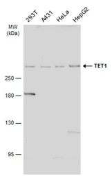 Anti-TET1 antibody [N3C1] used in Western Blot (WB). GTX124207