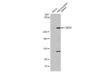 Anti-TET1 antibody [N3C1] used in Western Blot (WB). GTX124207