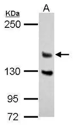 Anti-DZIP3 antibody used in Western Blot (WB). GTX124220