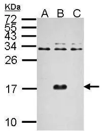 Anti-Dengue virus Capsid protein antibody used in Western Blot (WB). GTX124247