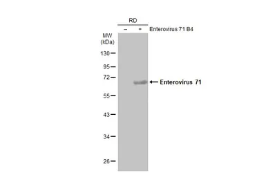 Anti-Enterovirus 71 antibody used in Western Blot (WB). GTX124261