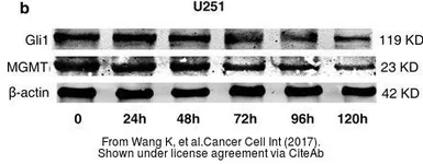 Anti-Gli1 antibody used in Western Blot (WB). GTX124274