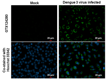 Anti-Dengue virus NS1 protein antibody used in Immunocytochemistry/ Immunofluorescence (ICC/IF). GTX124280