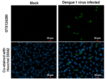 Anti-Dengue virus NS1 protein antibody used in Immunocytochemistry/ Immunofluorescence (ICC/IF). GTX124280