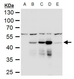 Anti-Dengue virus NS1 protein antibody used in Western Blot (WB). GTX124280