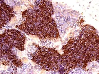 Anti-alpha Tubulin antibody used in IHC (Paraffin sections) (IHC-P). GTX124303