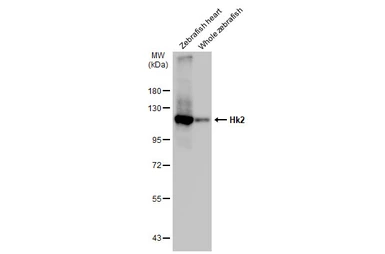 Anti-Hk2 antibody used in Western Blot (WB). GTX124375