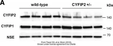 Anti-Cyfip2 antibody used in Western Blot (WB). GTX124387