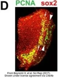 Anti-Sox2 antibody used in IHC (Whole mount) (IHC-Wm). GTX124477