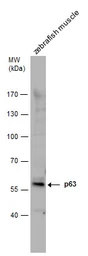 Anti-Tp63 antibody used in Western Blot (WB). GTX124660