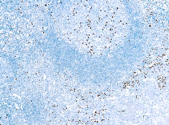 Anti-IRF4 / MUM1 antibody [MUM1p] used in IHC (Paraffin sections) (IHC-P). GTX12501