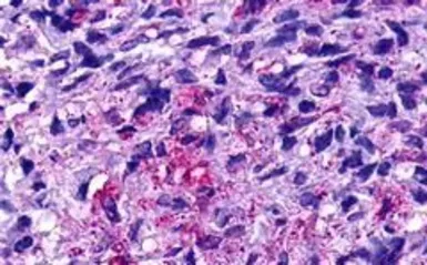 Anti-GPR19 antibody used in IHC (Paraffin sections) (IHC-P). GTX12545