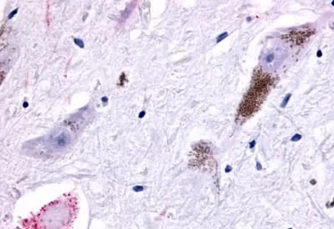 Anti-GPR45 antibody used in IHC (Paraffin sections) (IHC-P). GTX12574