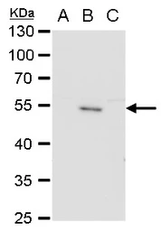 Anti-Japanese encephalitis virus Envelope antibody used in Western Blot (WB). GTX125867