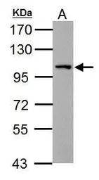 Anti-Thbs4b antibody used in Western Blot (WB). GTX125869