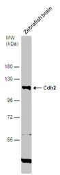 Anti-Cdh2 antibody used in Western Blot (WB). GTX125885