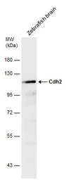 Anti-Cdh2 antibody used in Western Blot (WB). GTX125885