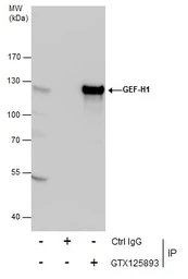 Anti-GEF-H1 antibody used in Immunoprecipitation (IP). GTX125893
