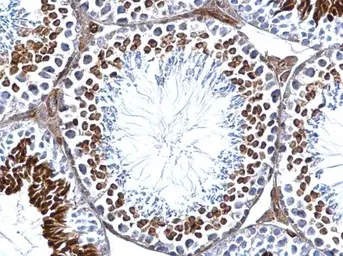 Anti-GEF-H1 antibody used in IHC (Paraffin sections) (IHC-P). GTX125893
