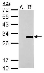 Anti-Galectin 3 antibody used in Western Blot (WB). GTX125897