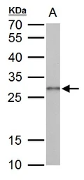 Anti-Galectin 3 antibody used in Western Blot (WB). GTX125897