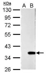 Anti-Galectin 4 antibody used in Western Blot (WB). GTX125898