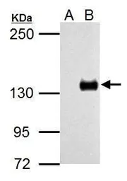Anti-TLR7 antibody used in Western Blot (WB). GTX125910