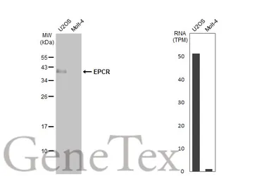 Anti-EPCR antibody used in Western Blot (WB). GTX125912