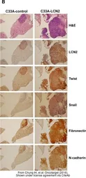 Anti-SNAI1 antibody used in IHC (Paraffin sections) (IHC-P). GTX125918