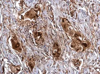 Anti-SNAI1 antibody used in IHC (Paraffin sections) (IHC-P). GTX125918