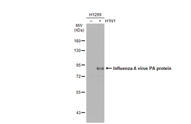 Anti-Influenza A virus PA protein antibody used in Western Blot (WB). GTX125932