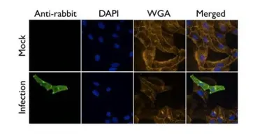 Anti-Influenza A virus M2 (matrix protein) antibody used in Immunocytochemistry/ Immunofluorescence (ICC/IF). GTX125951