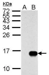 Anti-Influenza A virus M2 (matrix protein) antibody used in Western Blot (WB). GTX125951