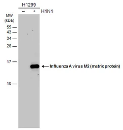 Anti-Influenza A virus M2 (matrix protein) antibody used in Western Blot (WB). GTX125951