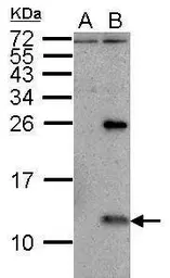 Anti-Influenza A virus NS2 / NEP antibody used in Western Blot (WB). GTX125952