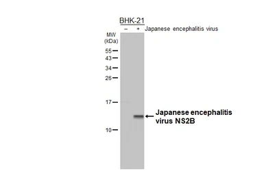 Anti-Japanese encephalitis virus NS2B antibody used in Western Blot (WB). GTX125972