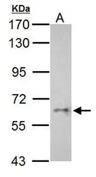 Anti-Cyp26c1 antibody used in Western Blot (WB). GTX125985