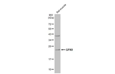 Anti-GPX8 antibody used in Western Blot (WB). GTX125992