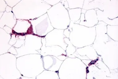 Anti-GPCR HM74 antibody used in IHC (Paraffin sections) (IHC-P). GTX12610