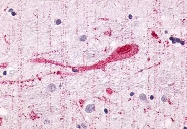 Anti-GPR55 antibody used in IHC (Paraffin sections) (IHC-P). GTX12700